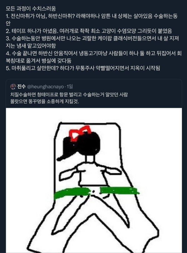 넌 똥꼬를 소중히 여기지 않았엉